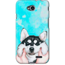 Чехол на LG L70 Dual D325 Улыбнись (4276u-201)