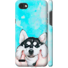 Чехол на LG Q6 Улыбнись (4276c-1094)