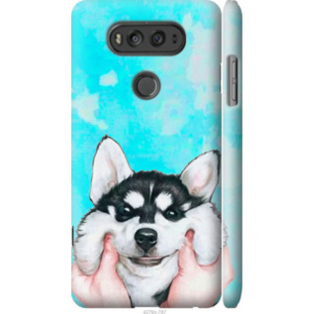 Чохол на LG V20 Улыбнись (4276c-787)