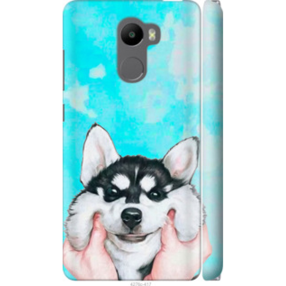 Чехол на Xiaomi Redmi 4 Улыбнись (4276c-417)