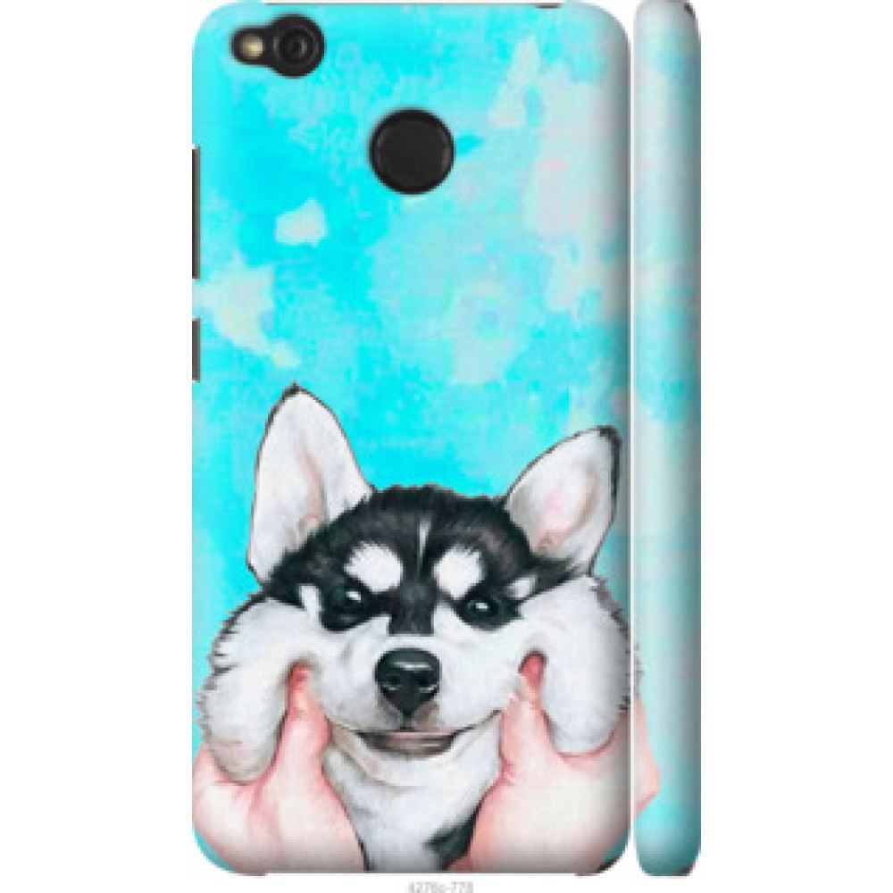 Чехол на Xiaomi Redmi 4X Улыбнись (4276c-778)