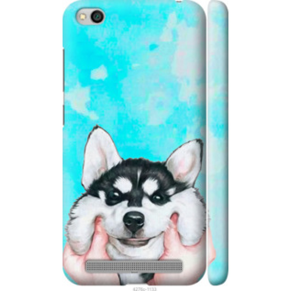 Чехол на Xiaomi Redmi 5A Улыбнись (4276c-1133)